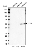 Western blot analysis in U2OS cells transfected with control siRNA, target specific siRNA probe #1 and #2, using Anti-CCT2 antibody. Remaining relative intensity is presented.