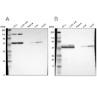 Western blot analysis using Anti-CCT2 antibody HPA003198 (A) shows similar pattern to independent antibody HPA003197 (B).