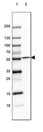 Lane 1: Marker [kDa] 250, 130, 100, 70, 55, 35, 25, 15, 10_br/_Lane 2: Human Cerebral Cortex tissue
