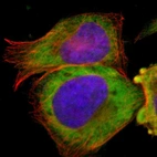 Immunofluorescent staining of human cell line U-2 OS shows localization to cytosol.