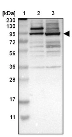 Lane 1: Marker [kDa] 230, 130, 95, 72, 56, 36, 28, 17, 11_br/_Lane 2: Human cell line RT-4_br/_Lane 3: Human cell line U-251MG sp