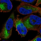 Immunofluorescent staining of human cell line RH-30 shows localization to intermediate filaments.