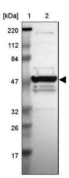 Lane 1: Marker [kDa] 220, 112, 84, 47, 32, 26, 17_br/_Lane 2: Human cell line RT-4