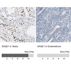 Anti-SAGE1 Antibody