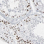 Immunohistochemical staining of human testis shows high expression.