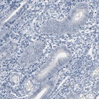 Immunohistochemical staining of human endometrium shows low expression as expected.