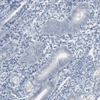 Immunohistochemical staining of human endometrium shows low expression as expected.