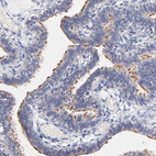 Anti-RIBC2 Antibody