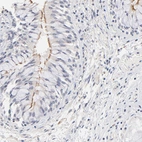 Immunohistochemical staining of human bronchus shows moderate positivity in cilia in respiratory epithelial cells.