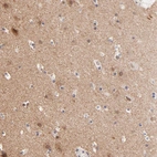 Immunohistochemical staining of human cerebral cortex shows moderate positivity in neuropil.