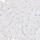 Immunohistochemical staining of human skeletal muscle shows no positivity in myocytes as expected.