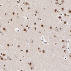 Anti-ZMYM3 Antibody