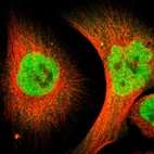 Immunofluorescent staining of human cell line U-251 MG shows localization to nucleoplasm.