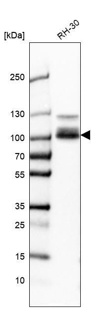 Anti-CLCN5 Antibody