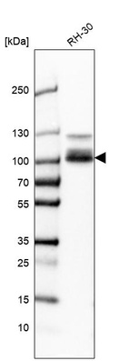 Anti-CLCN5 Antibody