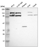 Western blot analysis in human cell line RT-4, human cell line U-251 MG, human plasma, human liver tissue and human tonsil tissue.