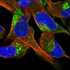 Immunofluorescent staining of human cell line RH-30 shows localization to cytosol & the Golgi apparatus.