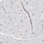 Anti-OGFOD1 Antibody