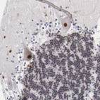 Immunohistochemical staining of human cerebellum shows strong nuclear positivity in Purkinje cells.