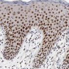 Immunohistochemical staining of human skin shows strong nuclear positivity in squamous epithelial cells.