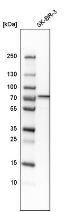 Western blot analysis in human cell line SK-BR-3.