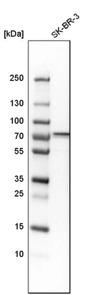 Western blot analysis in human cell line SK-BR-3.