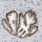 Anti-PSMD5 Antibody