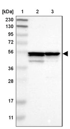 Lane 1: Marker [kDa] 230, 130, 95, 72, 56, 36, 28, 17, 11_br/_Lane 2: Human cell line RT-4_br/_Lane 3: Human cell line U-251MG sp