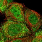 Immunofluorescent staining of human cell line A-431 shows localization to nucleoplasm & cytosol.
