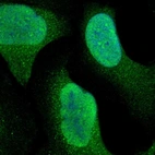 Immunofluorescent staining of human cell line U-2 OS shows positivity in nucleus & cytoplasm.