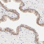 Immunohistochemical staining of human prostate shows moderate membranous positivity in glandular cells.