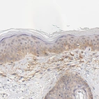 Immunohistochemical staining of human skin shows weak membranous positivity in squamous epithelial cells.