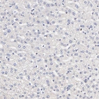 Immunohistochemical staining of human liver shows no positivity in hepatocytes as expected.