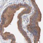 Anti-VAV2 Antibody