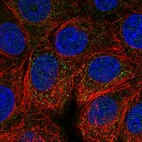 Immunofluorescent staining of human cell line MCF7 shows localization to vesicles.
