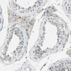 Anti-ZNF184 Antibody