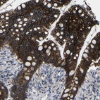 Anti-ZNF90 Antibody