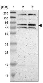 Lane 1: Marker [kDa] 230, 130, 95, 72, 56, 36, 28, 17, 11_br/_Lane 2: Human cell line RT-4_br/_Lane 3: Human cell line U-251MG sp