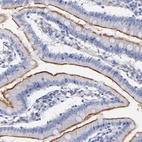 Anti-SLC44A2 Antibody