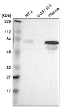 Western blot analysis in human cell line RT-4, human cell line U-251 MG and human plasma.