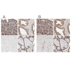 Immunohistochemical staining of human gastrointestinal, prostate, skeletal muscle and thyroid gland using Anti-PDIA3 antibody HPA003230 (A) shows similar protein distribution across tissues to independent antibody HPA002645 (B).