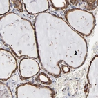 Immunohistochemical staining of human thyroid gland shows strong cytoplasmic positivity in glandular cells.