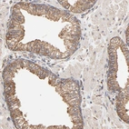 Immunohistochemical staining of human prostate shows moderate cytoplasmic positivity in glandular cells.