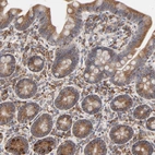 Immunohistochemical staining of human small intestine shows moderate to strong cytoplasmic positivity in glandular cells.