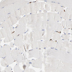 Immunohistochemical staining of human skeletal muscle shows no cytoplasmic positivity in myocytes as expected.