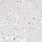 Anti-PDIA3 Antibody