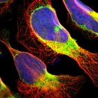 Immunofluorescent staining of human cell line U-2 OS shows localization to endoplasmic reticulum.