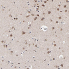 Anti-CHM Antibody