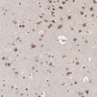 Immunohistochemical staining of human cerebral cortex shows moderate positivity in neurons.