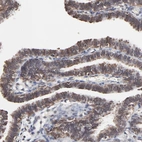 Immunohistochemical staining of human fallopian tube shows moderate cytoplasmic positivity in glandular cells.